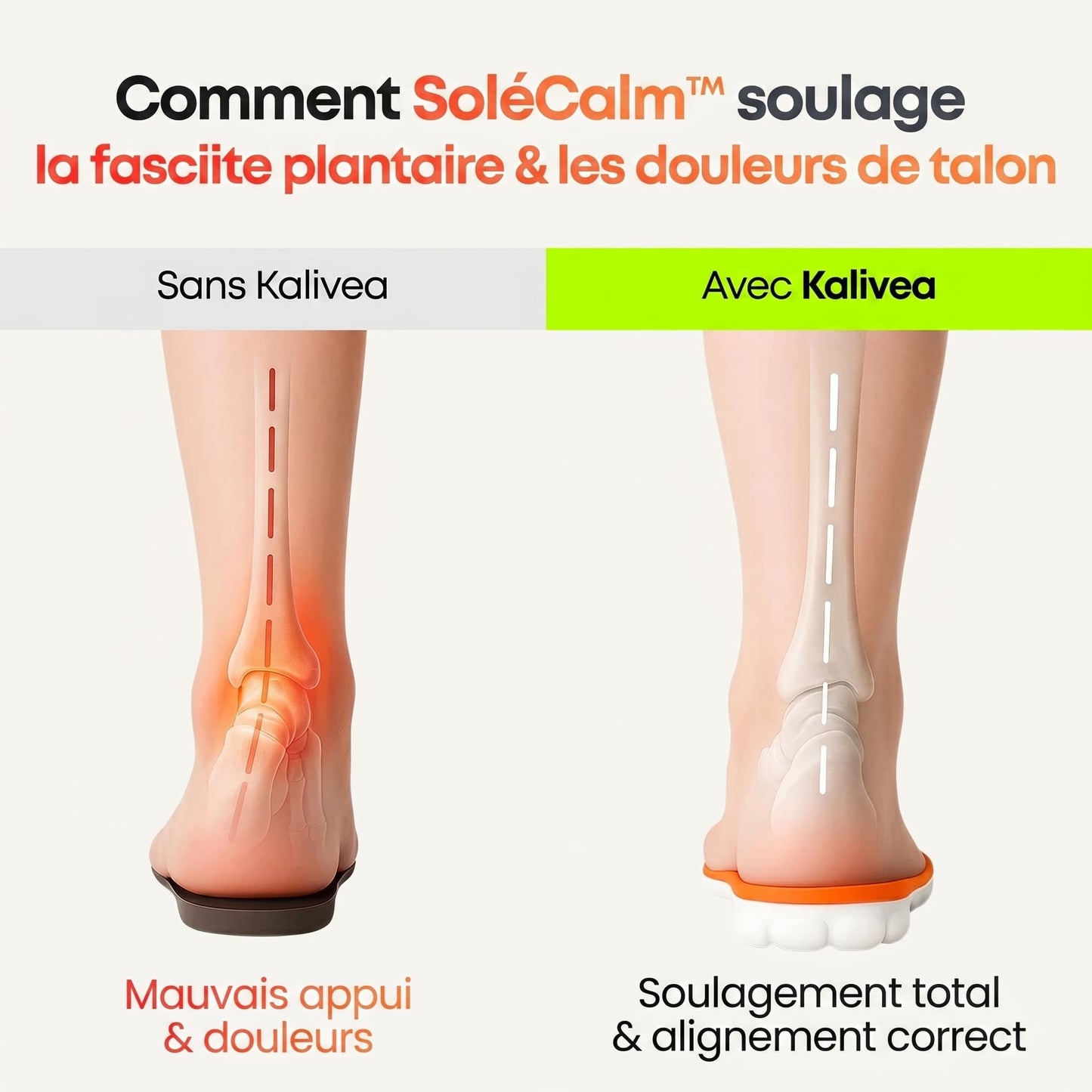 SoléCalm™ Semelles de soulagement pour douleurs de talon & fasciite plantaire